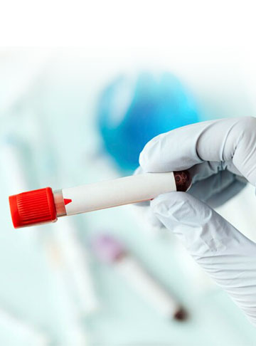 HCG Levels in IVF