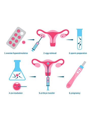 टेस्ट ट्यूब बेबी: प्रक्रिया, फायदे और IVF से अंतर