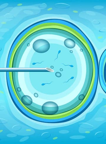 IVF Full Form