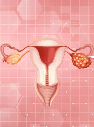 Ovarian Reserve Testing