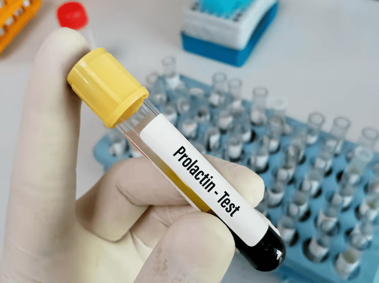 Prolactin Test in Hindi