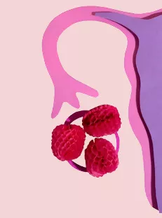 How to Treat PCOS Naturally