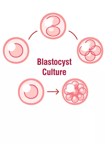 Blastocyst Culture and Embryo Transfer Procedure