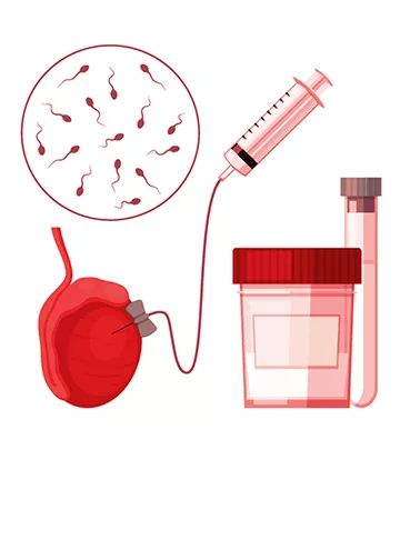 Why Choose Indira IVF for DFI Testing?